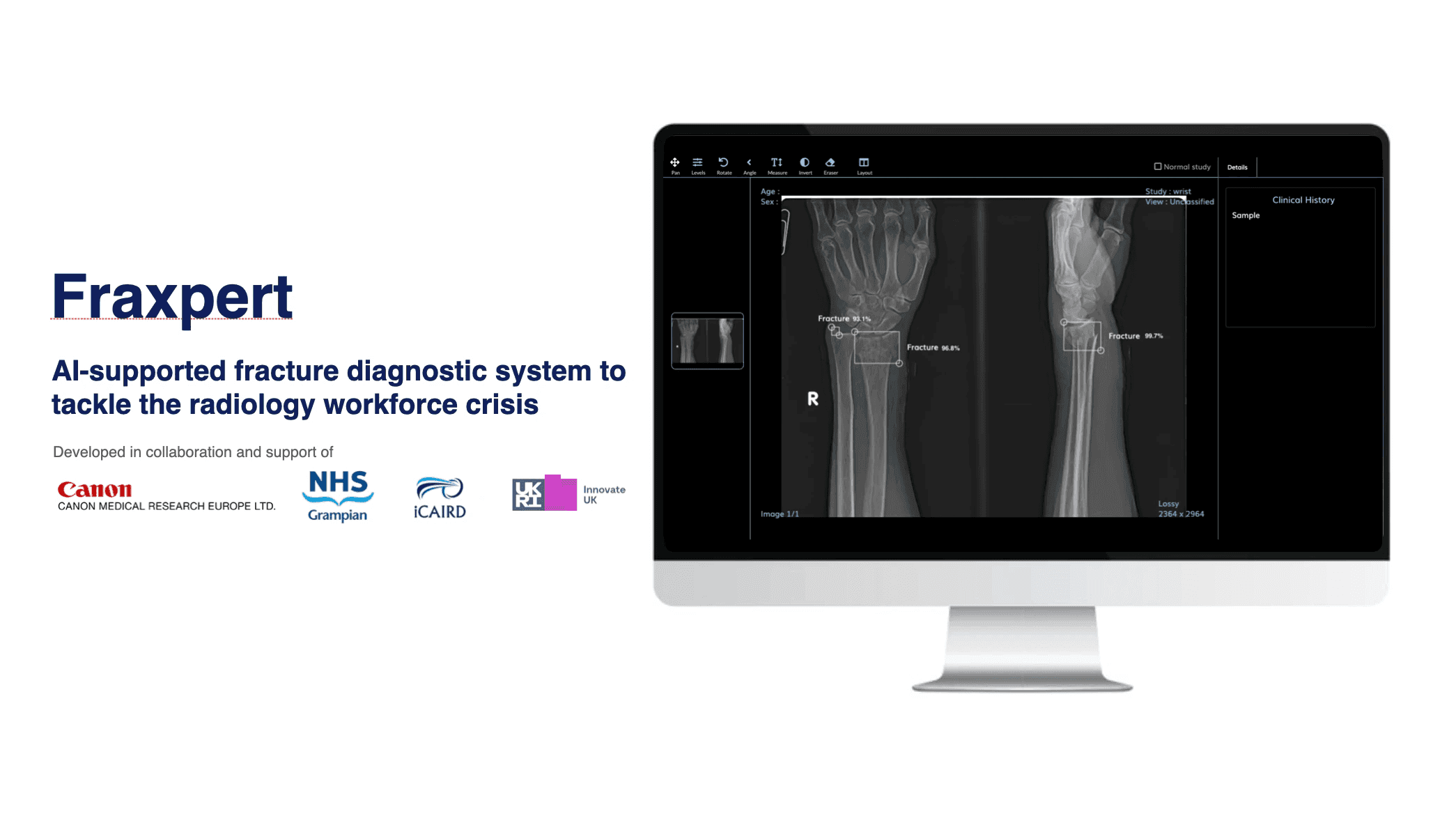 NHS Grampian project